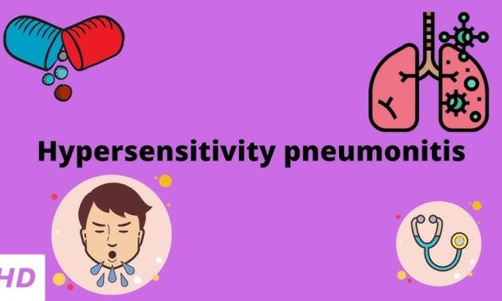 Hypersensitivity Pneumonitis Market
