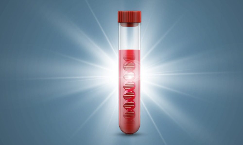 Liquid Biopsy Market - Better Time Ahead: Biocept, Roche Diagnostics ...