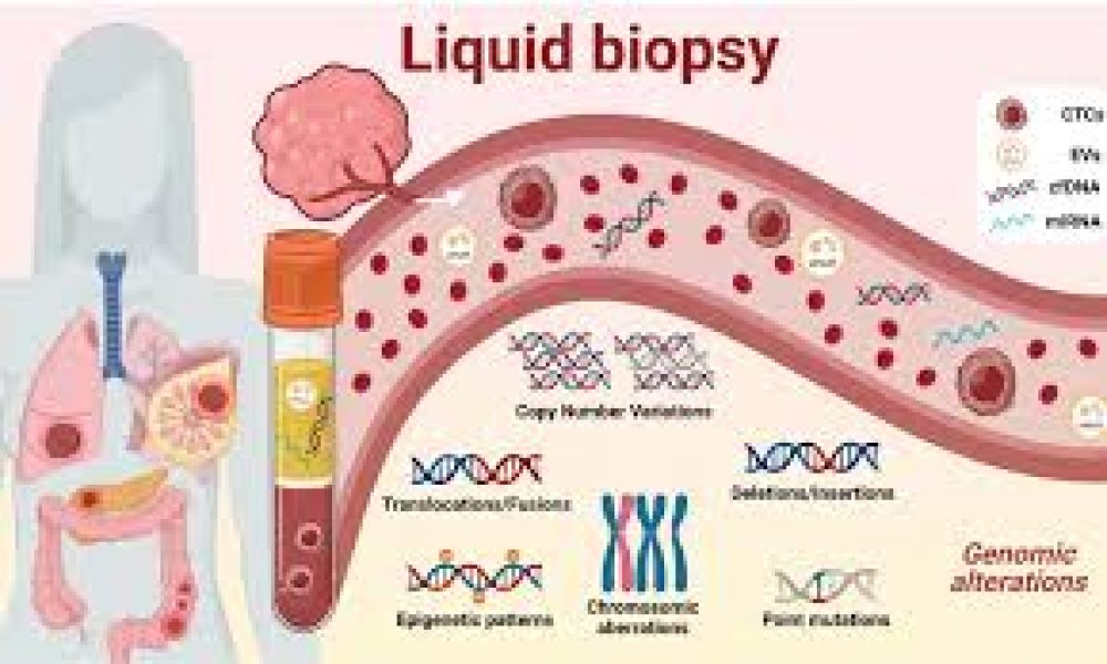 Liquid Biopsy Market