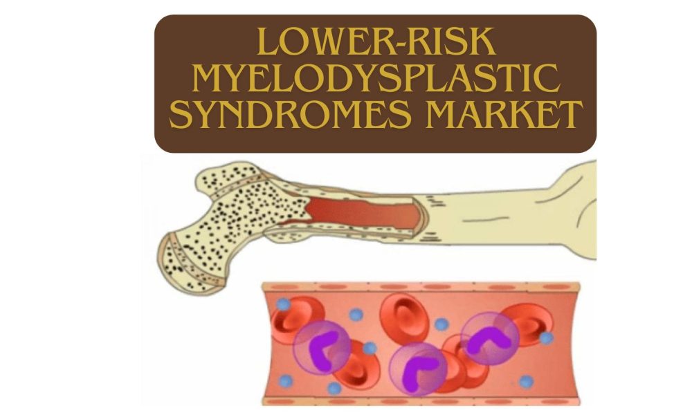 Lower-Risk Myelodysplastic Syndromes Market