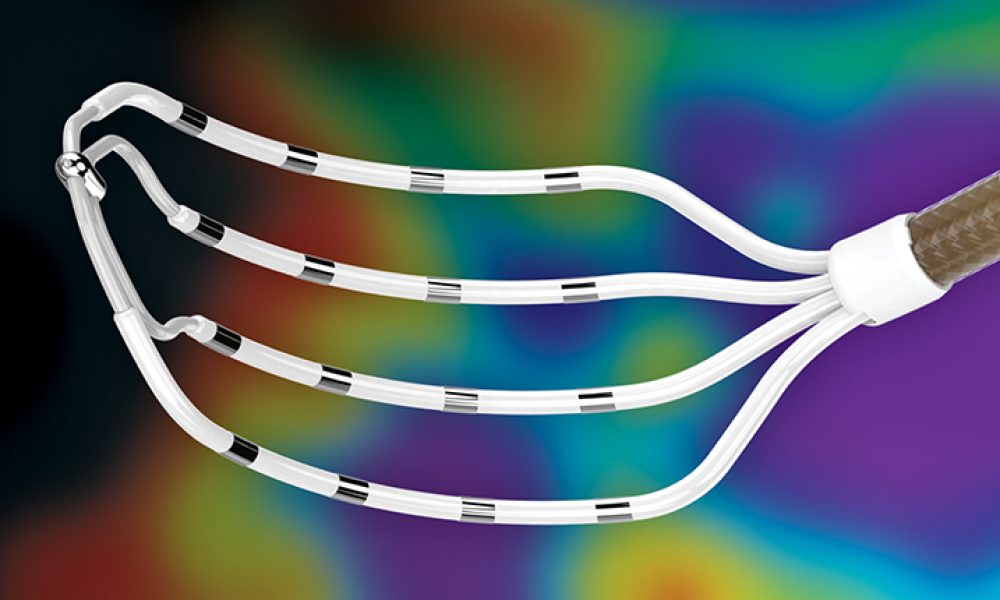 Mapping Catheters Market