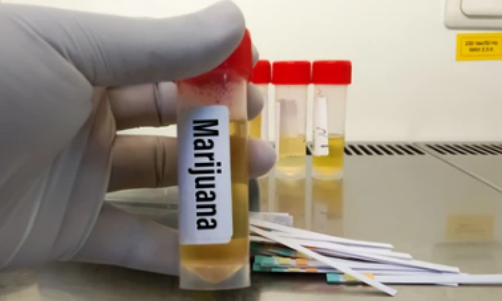 Marihuana Rapid Test Kit Market