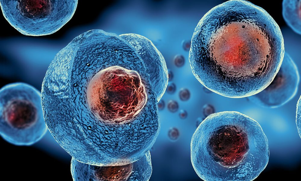 Mesenchymal Stem Cells