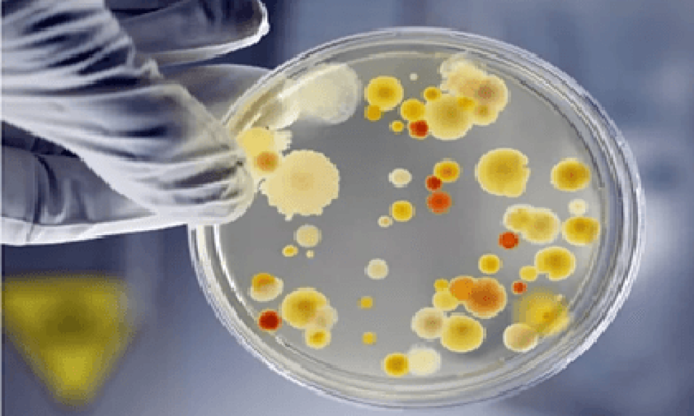 Microbial Cultures Market