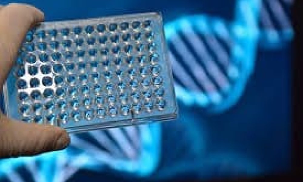 NGS Sample Preparation Market analysis