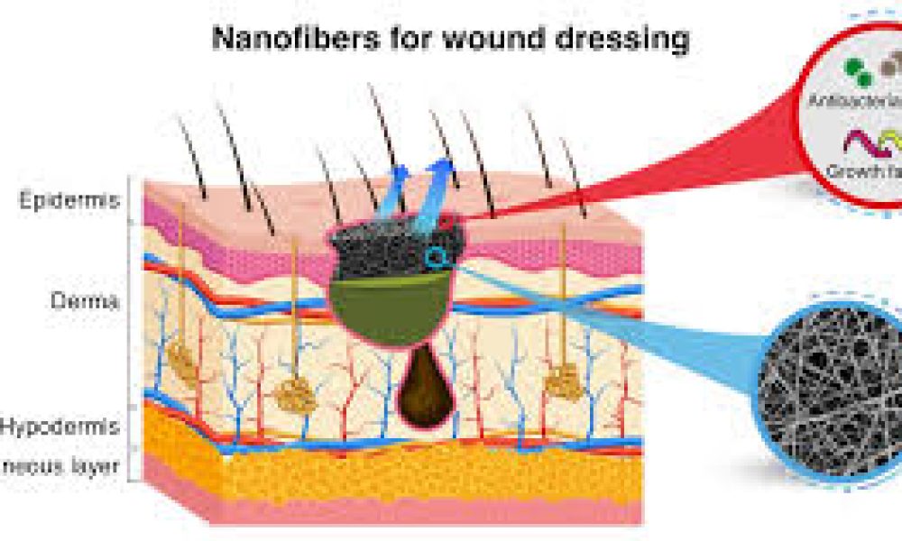 Nanofiber-Based Wound Dressings Market