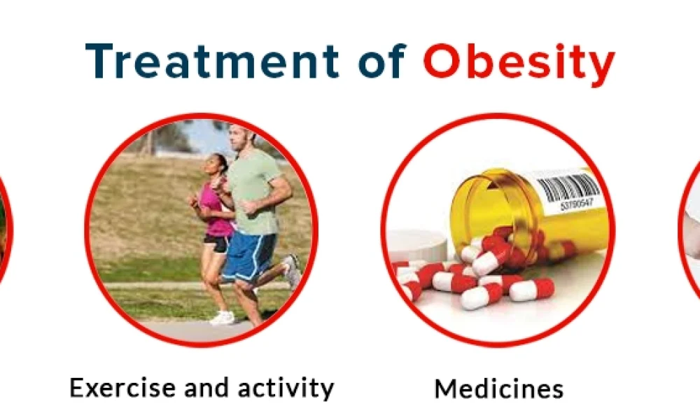 Obesity Treatment