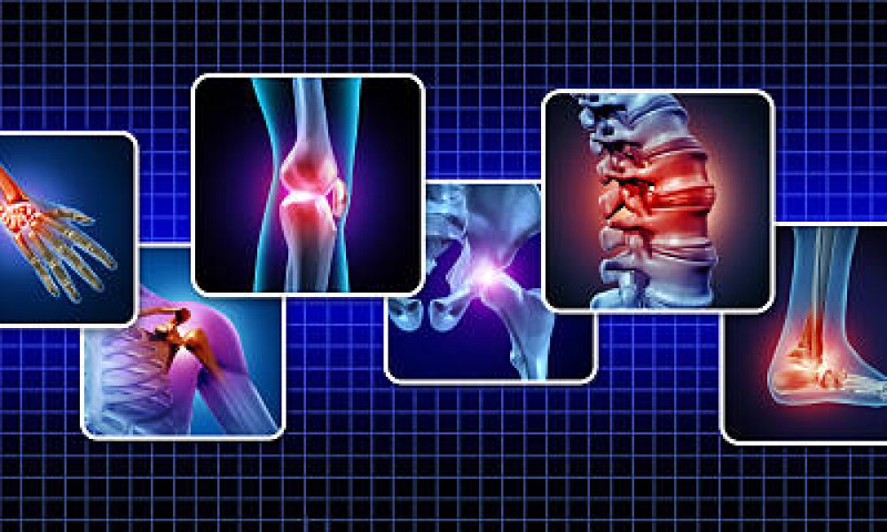 Human Joints Pain concept as skeleton and muscle anatomy of the body with a group of sore joints as a painful injury or arthritis illness symbol for health care and medical symptoms as a symbol of Rheumatology and orthopedics and physical rehabilitation.