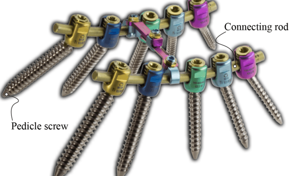 Pedicle Screw Rod System Market
