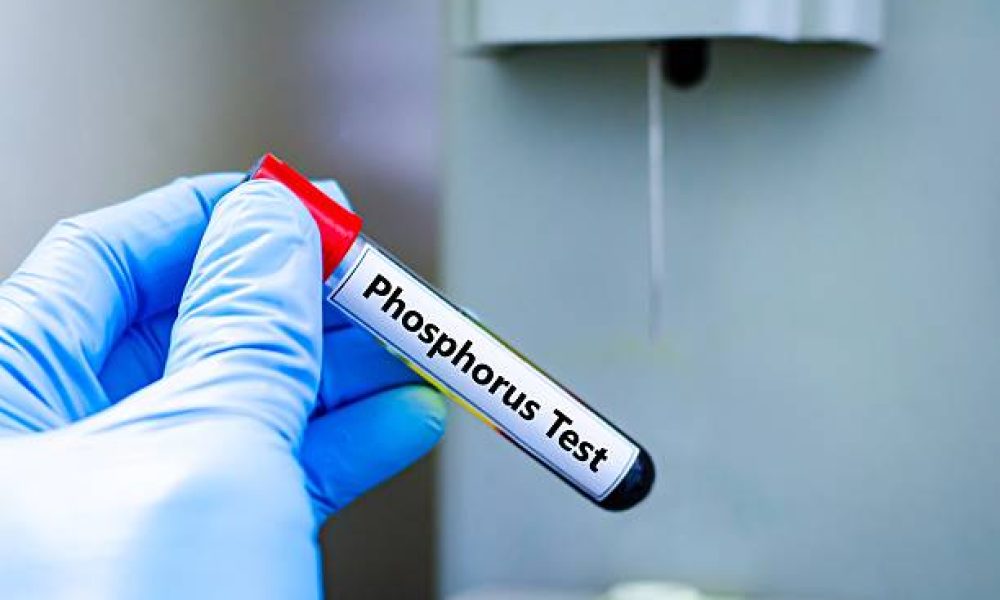 Phosphorus Acid Market Sector in Transition: Assessing Risk, Resilience ...