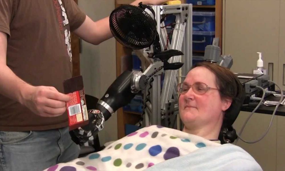 Quadriplegia Treatment Industry