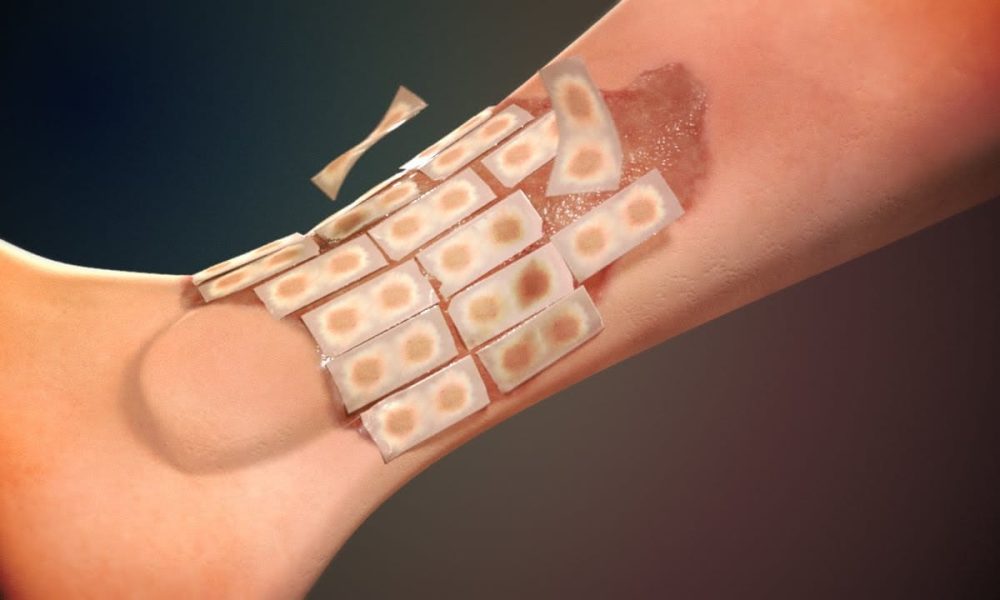 Regenerative Artificial Skin Industry