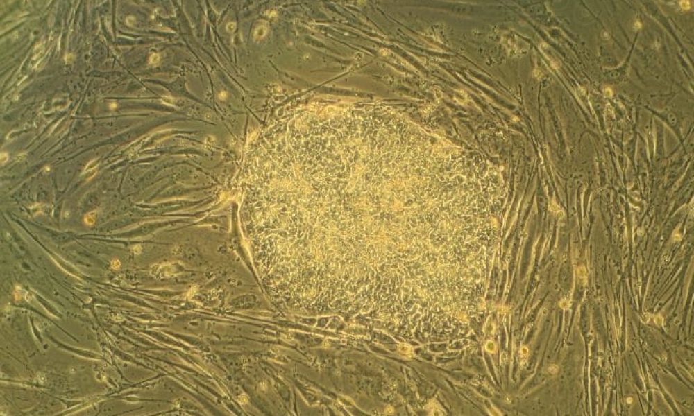 Regenerative Medicine