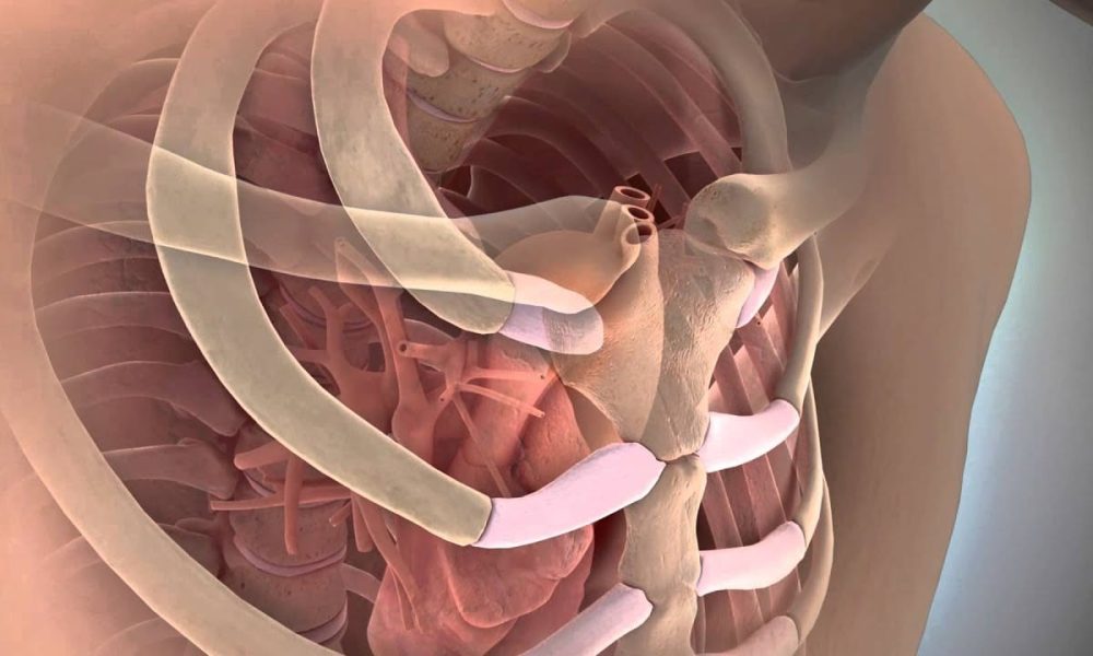 Rib Fracture Repair Systems Market Set to Experience Robust Growth USD ...