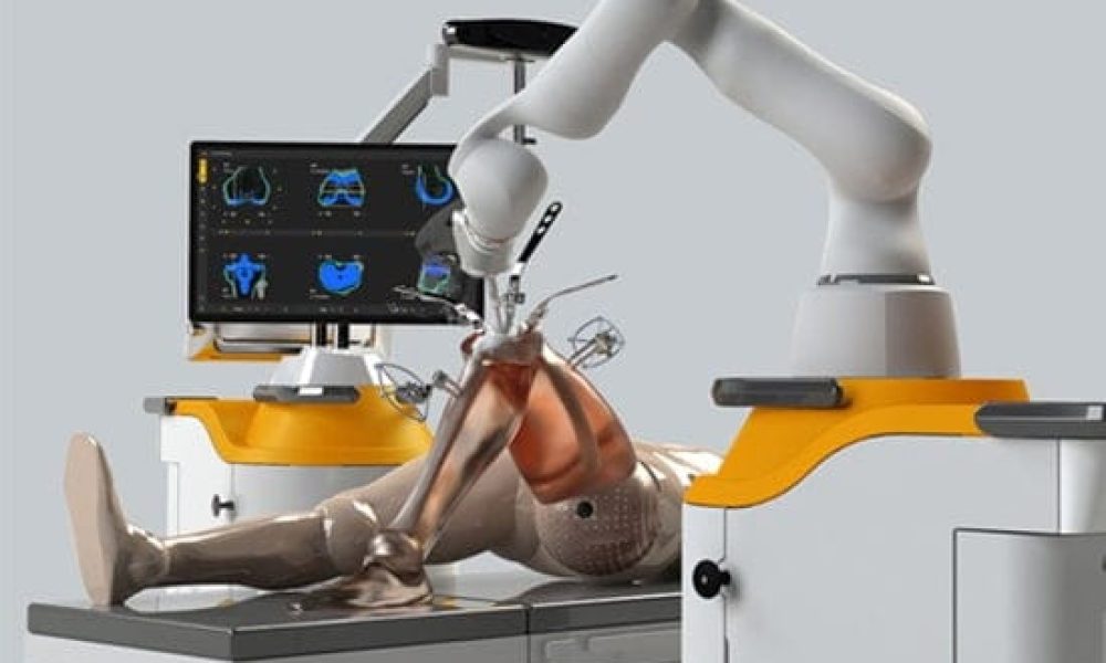 Robotic joint surgery