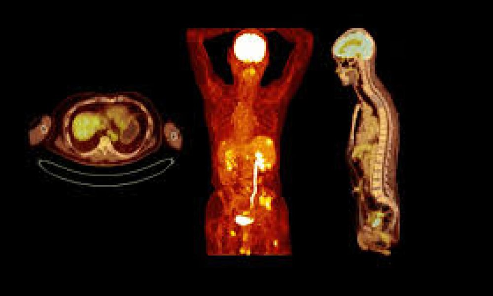 SPECT Radiopharmaceuticals Market