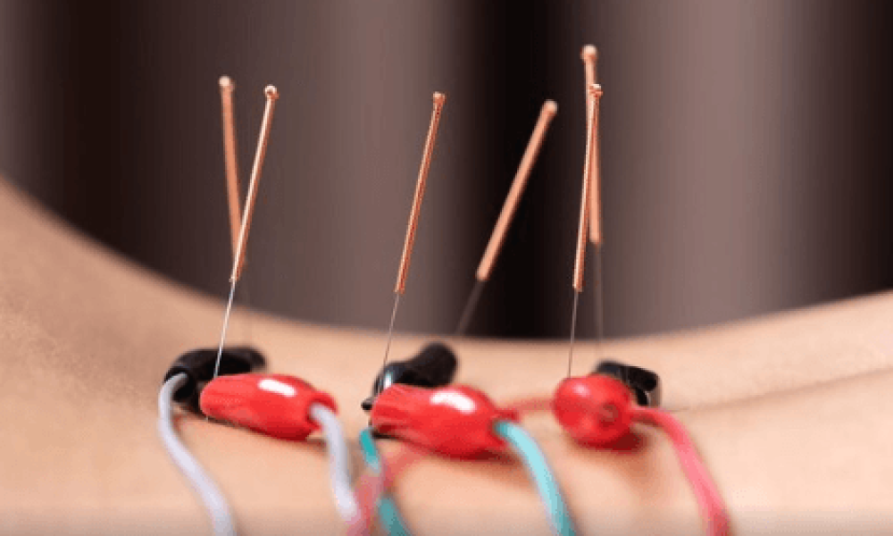 Acupuncture Laser Market