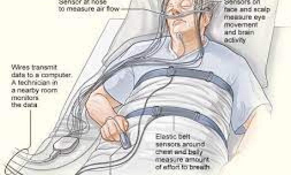 Sleep Apnea Diagnostic Systems Market May See Big Move: Embla Systems ...