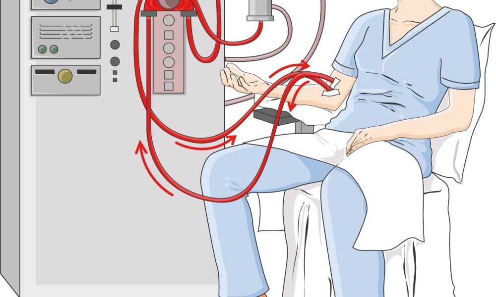 Smart Dialysis System Market