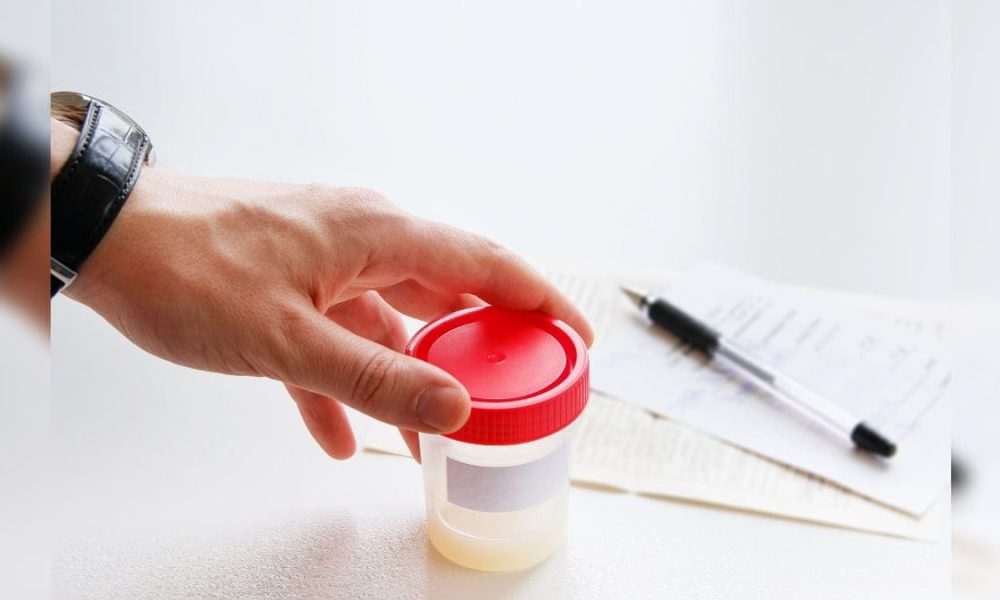 Sperm Quality Test Analyzer Market