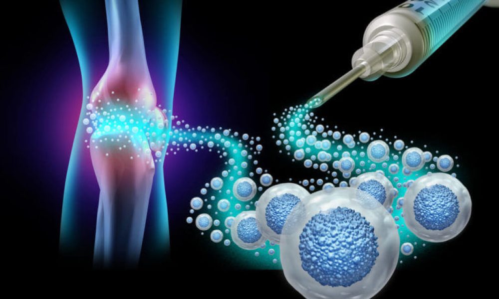 Stem Cell Therapy Market