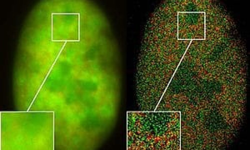 Super-Resolution Microscope Market