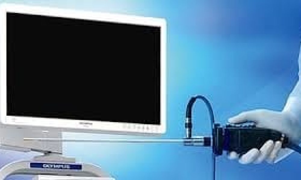 Surgical Endoscopy System Market to Eyewitness Massive Growth by 2030 ...