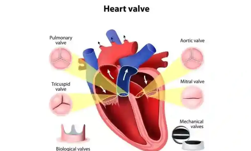Surgical Heart Valve Market