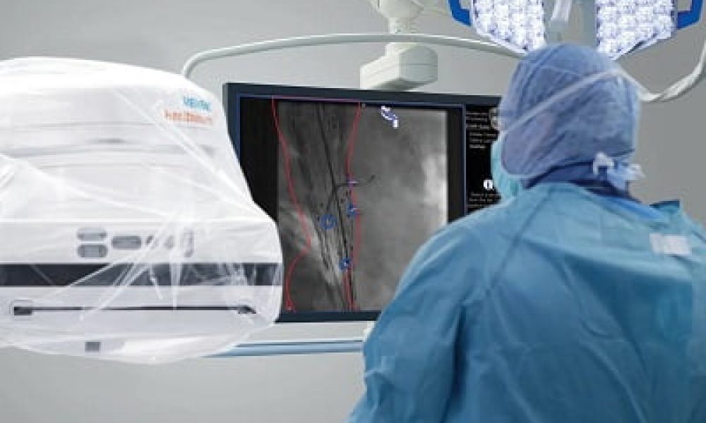 Surgical Imaging Market looks to expand its size in Overseas Market ...