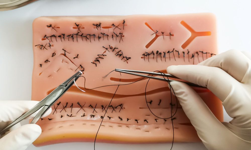 Surgical Sutures Market