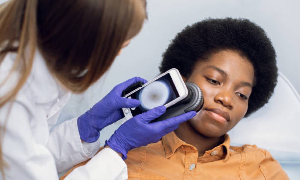 Close up of hands of female doctor holding dermatoscope for study of moles, birthmarks, warts, checking her patient's face. Beautiful afro american woman lying on the couch