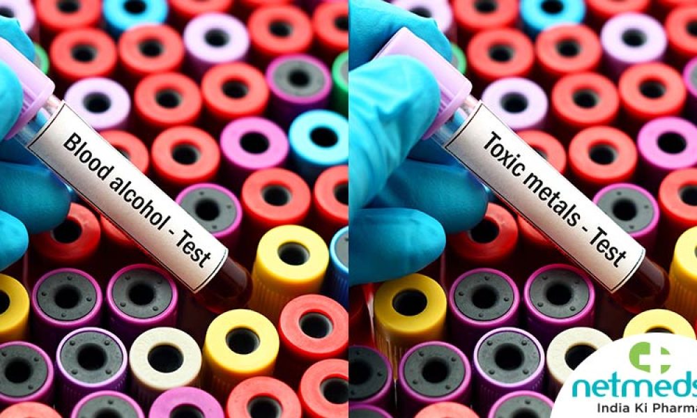 Toxicology testing Market
