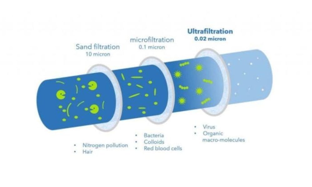 Ultrafiltration Market