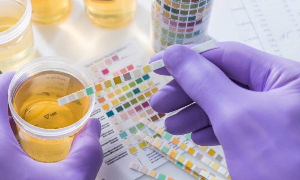 Urinalysis Market Size