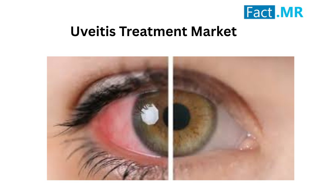 Uveitis Treatment Market