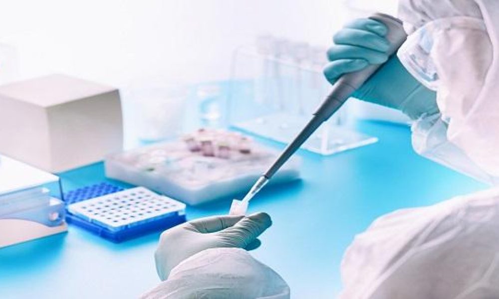 In-vitro Diagnostics Enzymes Market