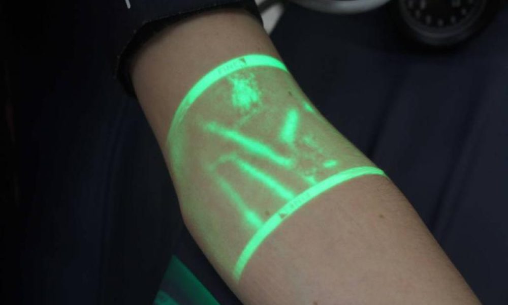 Vein Illuminator Market