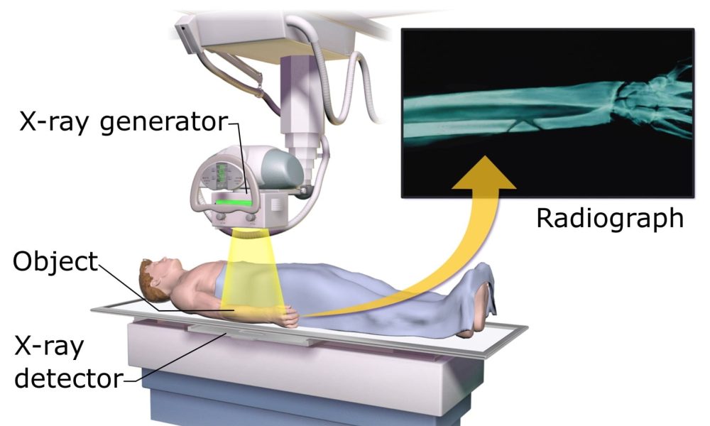 X-Ray Detectors