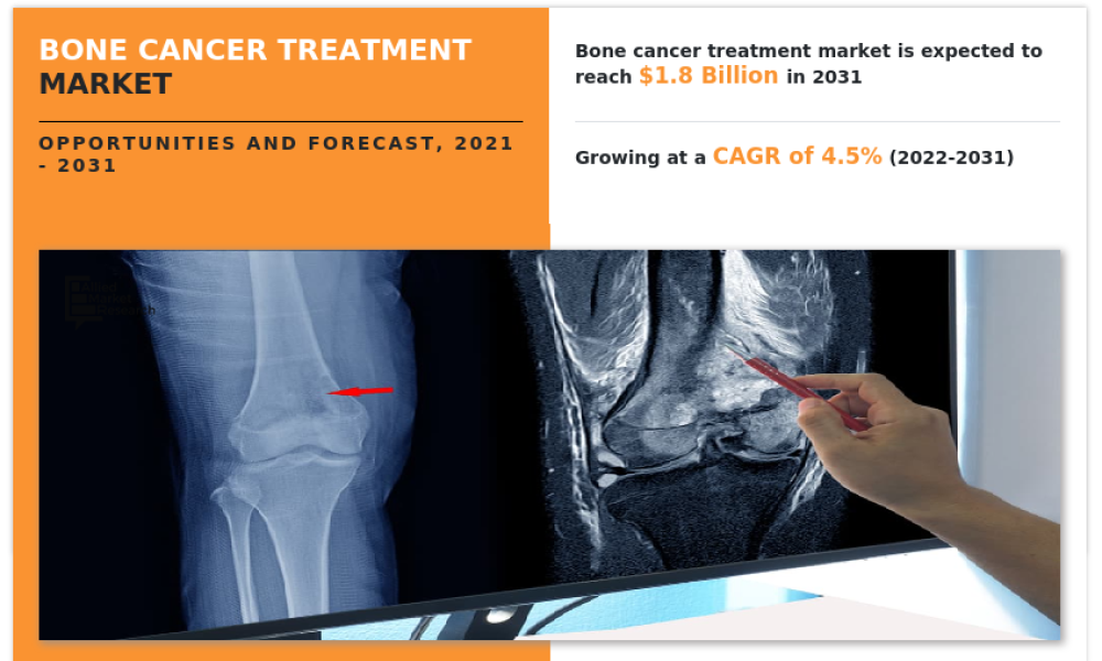 bone-cancer-treatment-market-1662036458
