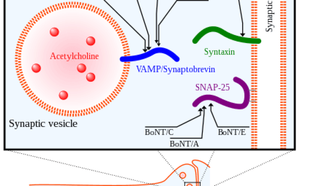 Botulinum Toxin