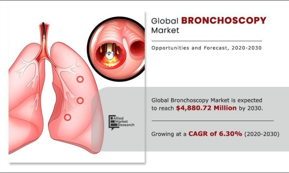Bronchoscopy: Market
