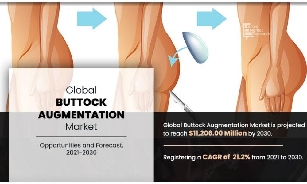 Buttock Augmentation Market
