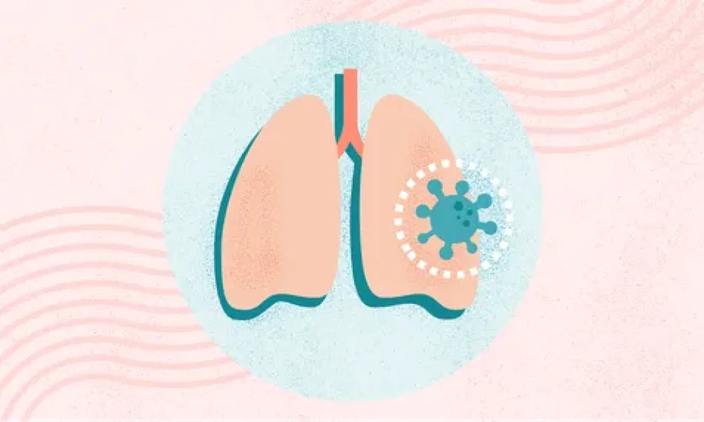 Pneumonia Diagnostics Market
