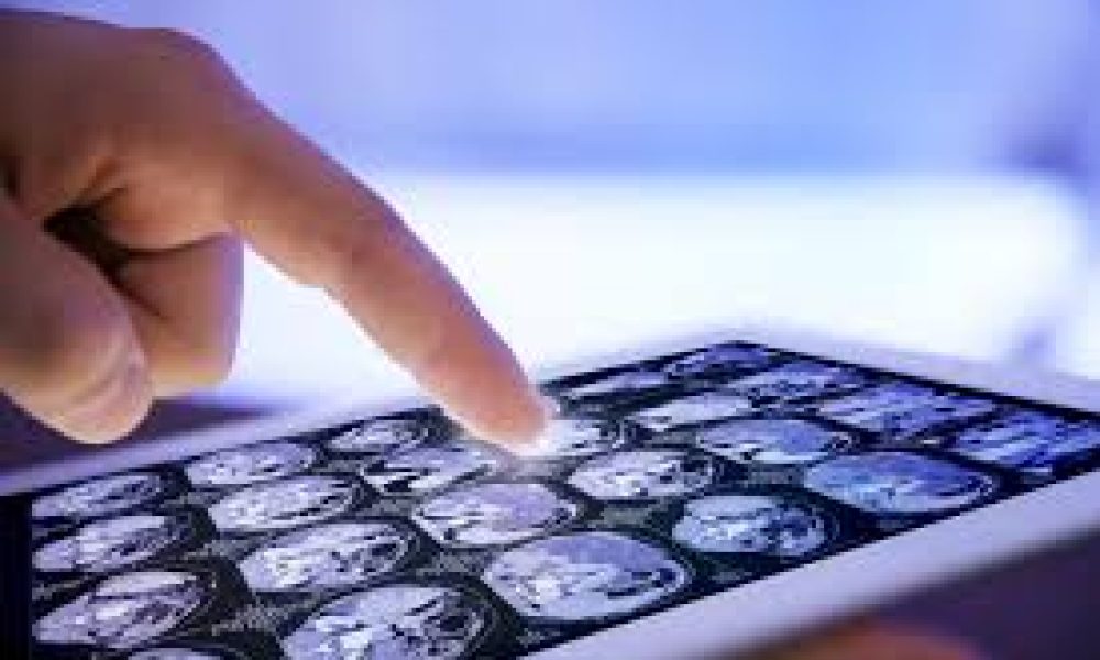 Clinical Trial Imaging Market