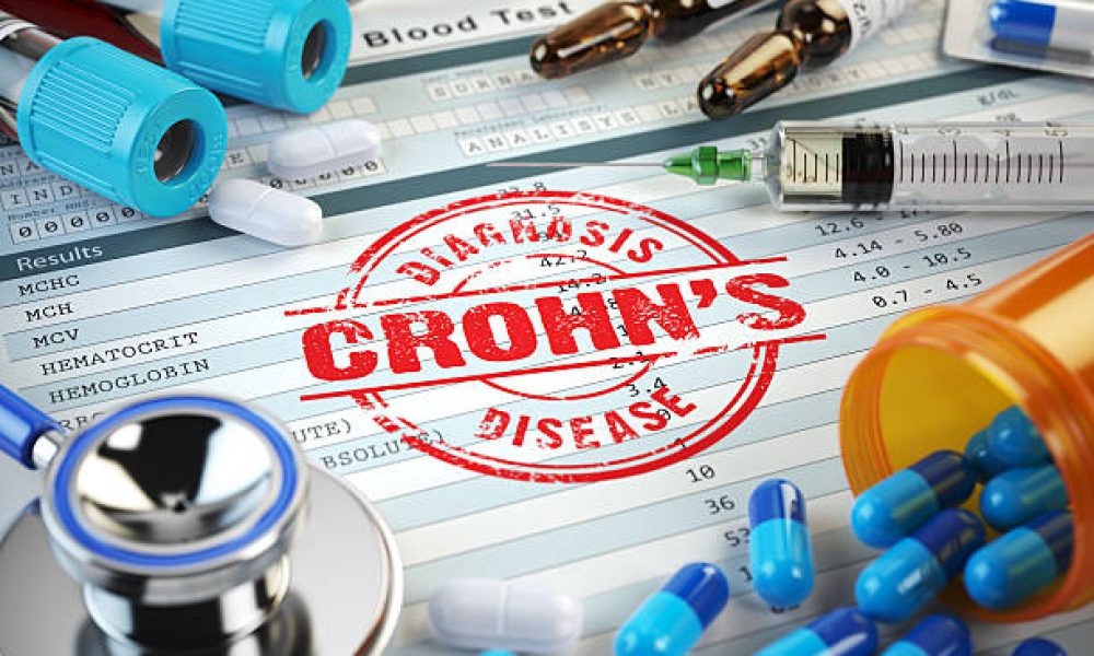 Crohn’s Disease Treatment Market