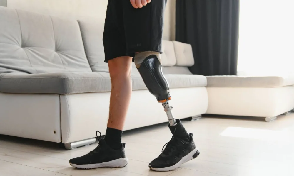Lower Limb Prosthetics Market