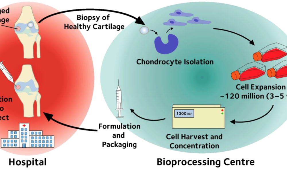 Autologous Cell Therapy Market