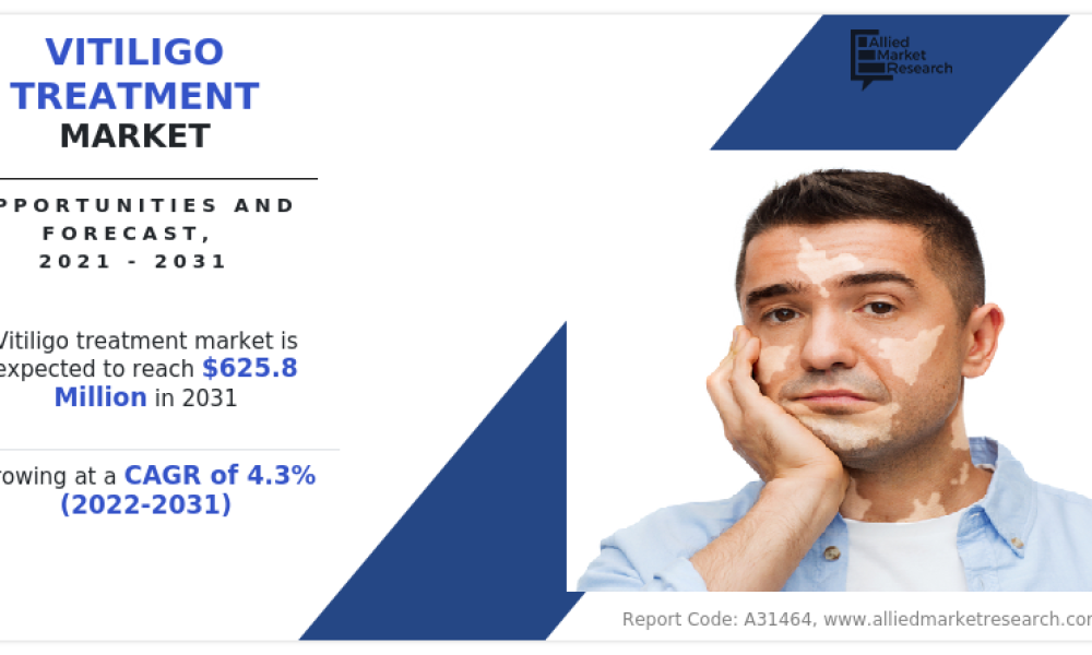 Vitiligo Treatment Market